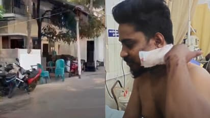  പുലർച്ചെ 2 മണി, വിളിക്കാത്ത വിവാഹത്തിനെത്തിയ യുവാവ് മദ്യം ചോദിച്ചു, പുറത്താക്കി; പിന്നാലെ അക്രമം