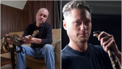 202 പാമ്പുകൾ കടിച്ചു, 4 ദിവസം വരെ കോമയിൽ, ഇപ്പോഴും ജീവനോടെ...; യുവാവിന്റെ രക്തം ആന്‍റിവെനമായി ഉപയോ​ഗിക്കും?