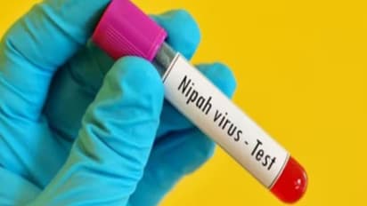 Nipah Virus
