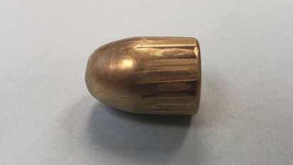 കമ്പി കൊണ്ട് പരിക്കേറ്റതാണെന്ന് പറഞ്ഞ് യുവാവ് ആശുപത്രിയിൽ; സ്കാനിംഗിൽ കണ്ടത് വെടിയുണ്ട, സംഭവം വയനാട്ടിൽ