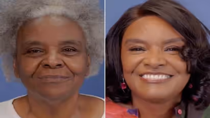 68 -കാരി അമ്മയുടെ മാറ്റം കണ്ടാൽ ഞെട്ടും, 1 കോടി രൂപയുടെ ശസ്ത്രക്രിയ മകന്റെ സമ്മാനം