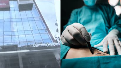 കൊഴുപ്പ് നീക്കൽ ശസ്ത്രക്രിയക്ക് ശേഷം രോഗി ഗുരുതരാവസ്ഥയിലായ സംഭവം; പിഴവില്ലെന്നും അത്യപൂർവ സങ്കീർണതയെന്നും ഐഎംഎ