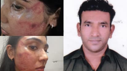 ജൂനിയര് അഭിഭാഷകയ്ക്ക് സീനിയര് അഭിഭാഷകന്റെ ക്രൂര മർദനം, ബാര് അസോസിയേഷന് പരാതി നൽകി