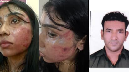 അഭിഭാഷകയെ മർദ്ദിച്ച കേസ്; 2 ദിവസം കഴിഞ്ഞിട്ടും പ്രതിയെ കണ്ടെത്തിയില്ല, പൊലീസ് ഇരുട്ടിൽ തപ്പുന്നു