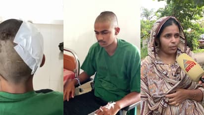 ഫുട്ബോൾ കളിക്കിടെയുണ്ടായ തർക്കം പരിഹരിക്കുന്നതിനിടെ 17കാരന് മർദനം; തലയോട്ടിക്ക് ക്ഷതമേറ്റ് ചികിത്സയിൽ 