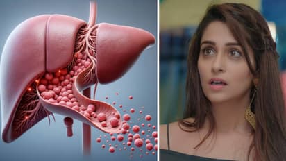 লিভার টিউমার ধরা পড়ল অভিনেত্রী দীপিকার, জানুন এই রোগের লক্ষণগুলো, দেখে নিন এক ঝলকে
