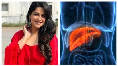 ആദ്യം വയറുവേദന അനുഭവപ്പെട്ടു, ബ്ലഡ് ടെസ്റ്റ് ചെയ്തു ; നടി ദീപിക കക്കറിനെ ബാധിച്ച ആ രോ​ഗത്തെ കുറിച്ചറിയാം 