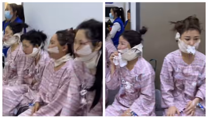 'ഹൊറർ സിനിമയിലെ രംഗമല്ല, കോസ്മെറ്റിക് സർജറി കഴിഞ്ഞ സ്ത്രീകളാണ് അവർ'; വീഡിയോ വൈറൽ