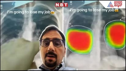 क्या AI डॉक्टरों की नौकरी खा जाएगा? एक्सपर्ट ने 1 सेकेंड में दे दिया रिप्लाई