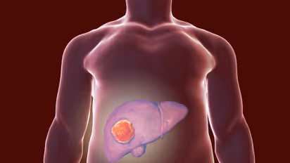 കരൾ ക്യാൻസർ സാധ്യത കുറയ്ക്കുന്നതിന് ഒഴിവാക്കേണ്ട ആറ് കാര്യങ്ങൾ