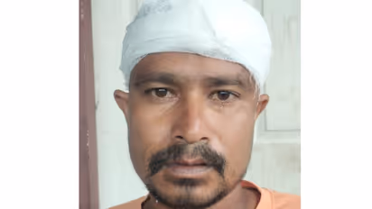 മദ്യത്തിന്റെ പേരില്‍ തര്‍ക്കം; രാത്രി വൈദ്യുതി വിച്ഛേദിച്ച് വീടുകയറി അക്രമം, ഇതര സംസ്ഥാന തൊഴിലാളിക്ക് പരിക്ക്