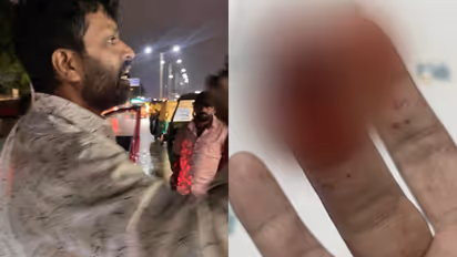 കാർ തിരിക്കവെ ഐ20 കാറിൽ മഴവെള്ളം തെറിച്ചു, യുവാവിന്‍റെ വിരൽ കടിച്ച് മുറിച്ചു; സംഭവം ബെംഗളൂരു ലുലുമാളിനടുത്ത്