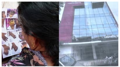 കൊഴുപ്പ് നീക്കൽ ശസ്ത്രക്രിയയിലെ പിഴവ്: ആരോഗ്യവകുപ്പിന്‍റെ ഉന്നത സമിതി ചികിത്സാപ്പിഴവ് പരിശോധിക്കും