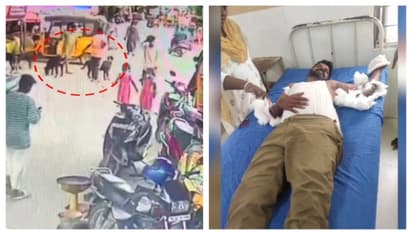 5 റോട്ട്വീലർ നായ്ക്കളുമായി റോഡിലിറങ്ങി 11കാരൻ; ഓട്ടോ ഡ്രൈവറെ ആക്രമിച്ചു, ഗുരുതര പരിക്ക്, ആശുപത്രിയിൽ