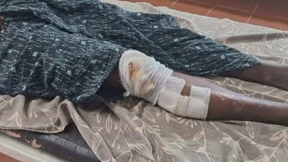 വീട്ടിലേക്കു പോകുമ്പോൾ പെട്ടെന്ന് മുന്നിൽ ചാടിവീണു, ​ഗുരുതര പരിക്ക്; വാഹനമടക്കം കുത്തിമറിച്ചിട്ട് കാട്ടുപന്നി