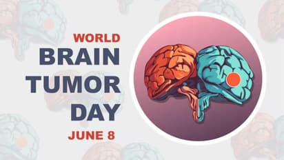 Top warning symptoms of brain tumor you must know