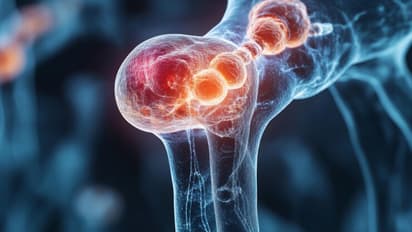 Health News: এবার শব্দ তরঙ্গে ছিন্নভিন্ন হবে টিউমার কোষ, আশ্বাস বিজ্ঞানীদের