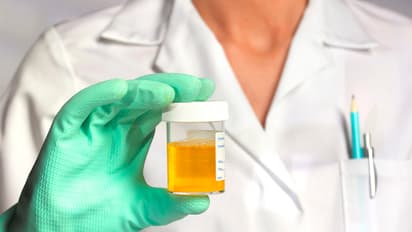 Scientists find a surprising use for urine