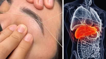 woman faced liver damage 