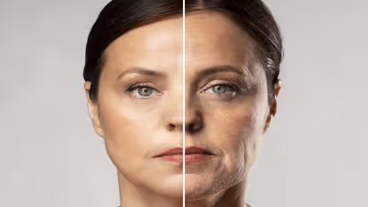 Skin Care Tips : डोळ्यांखालील सुरकुत्या कमी करण्याचे सोपे उपाय, दिसाल तरुण