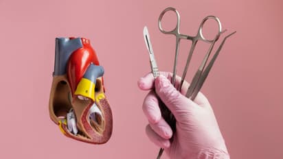 हार्ट ट्रांसप्लांट