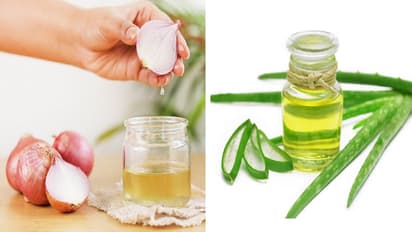 एलोवेरा Vs अनियन ऑयल