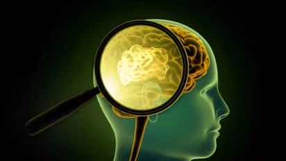 ब्रेन कैंसर का सबसे घातक रूप है ग्लियोब्लास्टोमा, खोपड़ी को गलाकर इम्यून सिस्टम को करता है हाईजैक