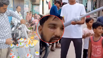 mp carbide gun accident children eye injury diwali 2025