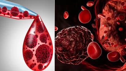 ब्लड कैंसर के लक्षण