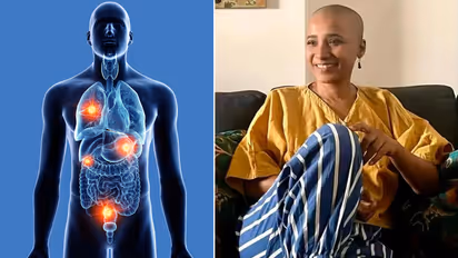 ओलिगोमेटास्टैटिक कैंसर के लक्षण और कारण