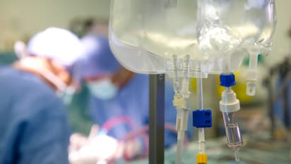 Organ Transplantation