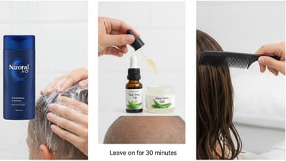 डैंड्रफ कैसे हटाएं