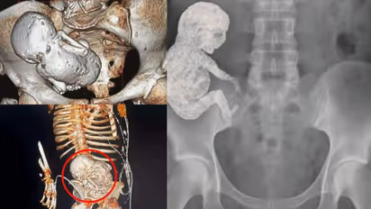 82 साल की महिला की SHOCKING रिपोर्ट, इस तस्वीर की हकीकत पर यकीन करना मुश्किल