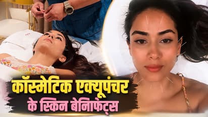 Cosmetic Acupuncture: चेहऱ्यावर इतक्या सुया? शाहिदच्या बायकोच्या ग्लोइंग स्किनचं हे आहे सीक्रेट!