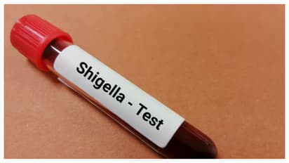 shigella