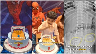 Birthday Cake बना 'सबसे डरावना सपना', 3 साल के बच्चे ने निगल लीं चॉकलेट में छिपी 2 कील-WATCH