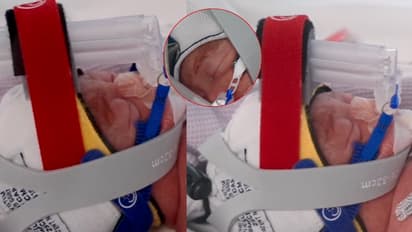 Rare Miracle Australian Mother Gives Birth to Identical Quadruplets