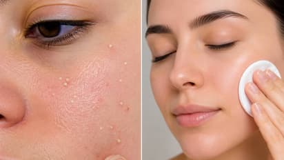 Whiteheads Cleaning Tips