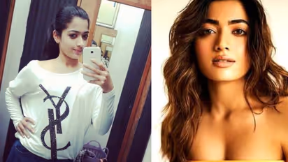 Nose Job: रश्मिका मंदानाने नाकाची सर्जरी केली? डॉक्टरच्या एका पोस्टमुळे सोशल मीडियावर मोठी चर्चा!