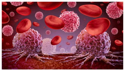 Blood Cancer Warning Signs You Shouldn’t Ignore: Know Leukemia, Lymphoma, Myeloma Symptoms