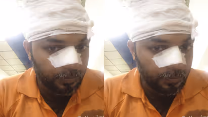 Thiruvananthapuram: Food Delivery Agent Attacked by Colleague Over Old Rivalry