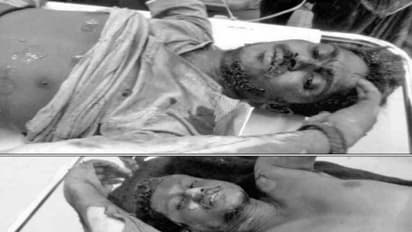 குண்டு வெடித்து 2 பேர் படுகாயம்…. பழிக்குப் பழி வாங்க நாட்டு வெடிகுண்டு தயாரித்த போது விபரீதம்…..