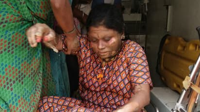 Husband sets teacher on fire in classroom!