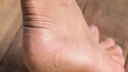 உங்கள் பாதங்களை மிருதுவாகவும், மென்மையாகவும் மாற்றும் சூப்பர் டிப்ஸ் இதோ...