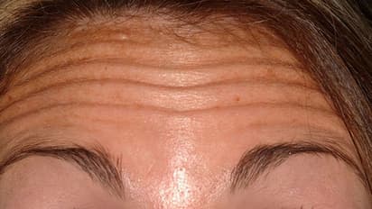 আপনি কি সত্যিই ভাগ্যবান, বলে দেবে আপনার কপালের আকৃতি, কপাল দেখে বুঝে নিন কে কেমন