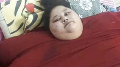 500 ಕೆ.ಜಿ ತೂಕದ ಈ ಮಹಿಳೆಗೆ ಮುಂಬೈನಲ್ಲಿ ತೂಕ ಇಳಿಸುವ ಶಸ್ತ್ರಚಿಕಿತ್ಸೆ