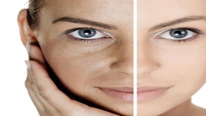 சருமம் பளபளப்புடன் இருக்க சில “சித்த மருத்துவ குறிப்புகள்”