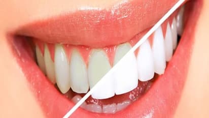 இந்த வீட்டுப் பொருட்கள் பற்களை ஆரோக்கியமாகவும், பளிச்சென்றும் மாற்றும்…