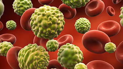 Two types of cancer that are hard to detect but can be treated