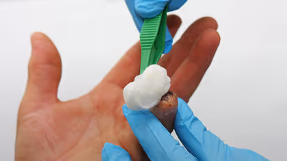 Irritated army man bites off ex-councillor's finger